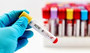 Badania na wirusowe zapalenie wątroby