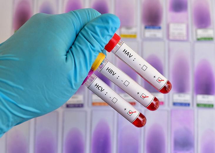 Wirusowe zapalenie wątroby